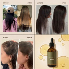 Huile capillaire - pousse cheveux & anti-chute